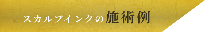スカルプインクの施術例